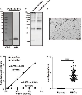 Receptor-Dependent Endocytosis Mediates α-Synuclein Oligomer Transport Into Red Blood Cells